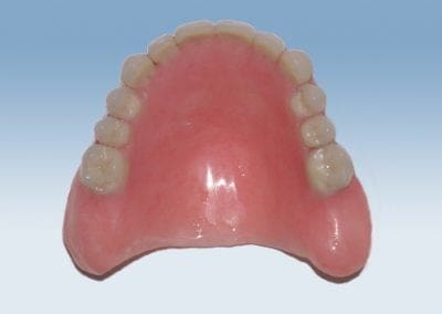 helprotese 1